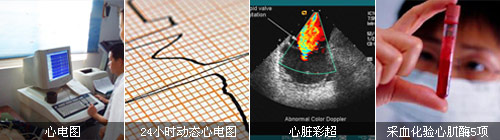肺心病的检查项目